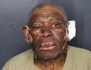 Man, 82, accused of setting fire to his ex after ending 42-year relationship