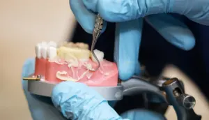 Plastic leaves its traces in unexpected places — like your dentist’s office