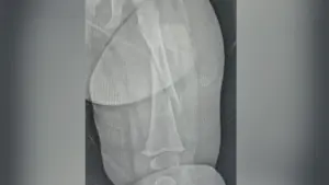 Ocoee baby suffered ‘catastrophic’ injury but how remains a mystery